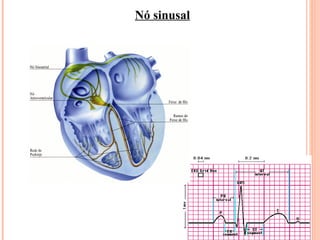 Nó sinusal 