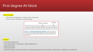 Wave Blockers (Bradyarrhythmias)Anilkumar md dm (1) (1).pptx