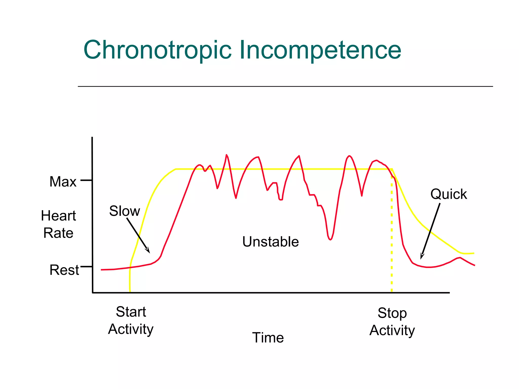 Chronotropic Incompetence Max Rest Heart Rate Time Start Activity Stop Activity Quick Unstable Slow 