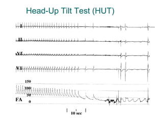 Head-Up Tilt Test (HUT) 