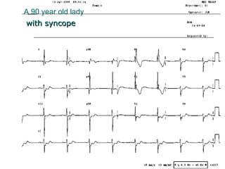 A 90 year old lady with syncope 