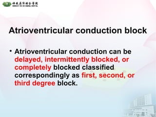 Atrioventricular conduction block

Atrioventricular conduction can be
delayed, intermittently blocked, or
completely blocked classified
correspondingly as first, second, or
third degree block.
 