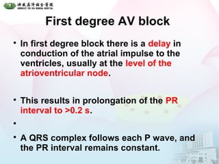 First degree AV block

In first degree block there is a delay in
conduction of the atrial impulse to the
ventricles, usually at the level of the
atrioventricular node.

This results in prolongation of the PR
interval to >0.2 s.


A QRS complex follows each P wave, and
the PR interval remains constant.
 