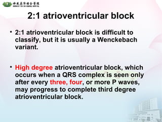 2:1 atrioventricular block

2:1 atrioventricular block is difficult to
classify, but it is usually a Wenckebach
variant.

High degree atrioventricular block, which
occurs when a QRS complex is seen only
after every three, four, or more P waves,
may progress to complete third degree
atrioventricular block.
 