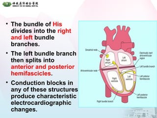 
The bundle of His
divides into the right
and left bundle
branches.

The left bundle branch
then splits into
anterior and posterior
hemifascicles.

Conduction blocks in
any of these structures
produce characteristic
electrocardiographic
changes.
 