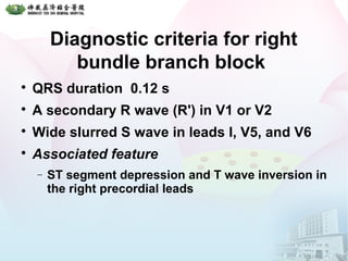 Diagnostic criteria for right
bundle branch block

QRS duration 0.12 s

A secondary R wave (R') in V1 or V2

Wide slurred S wave in leads I, V5, and V6

Associated feature
− ST segment depression and T wave inversion in
the right precordial leads
 