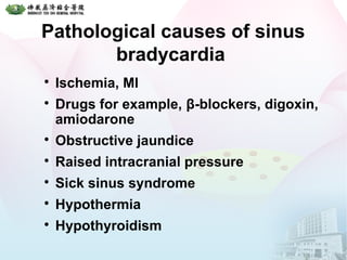 Pathological causes of sinus
bradycardia

Ischemia, MI

Drugs for example, β-blockers, digoxin,
amiodarone

Obstructive jaundice

Raised intracranial pressure

Sick sinus syndrome

Hypothermia

Hypothyroidism
 