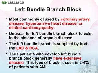 Left Bundle Branch Block

Most commonly caused by coronary artery
disease, hypertensive heart disease, or
dilated cardiomyopathy.

Unusual for left bundle branch block to exist
in the absence of organic disease.

The left bundle branch is supplied by both
the LAD & RCA.

Thus patients who develop left bundle
branch block generally have extensive
disease. This type of block is seen in 2-4%
of patients with AMI.
 