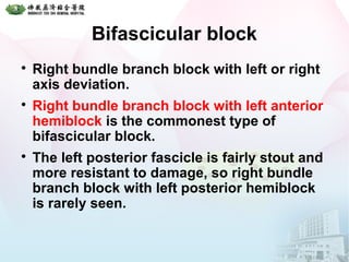 Bifascicular block

Right bundle branch block with left or right
axis deviation.

Right bundle branch block with left anterior
hemiblock is the commonest type of
bifascicular block.

The left posterior fascicle is fairly stout and
more resistant to damage, so right bundle
branch block with left posterior hemiblock
is rarely seen.
 