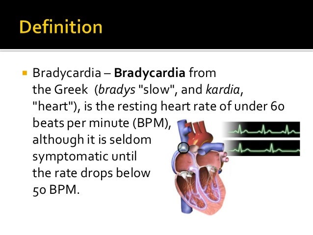 bradycardia