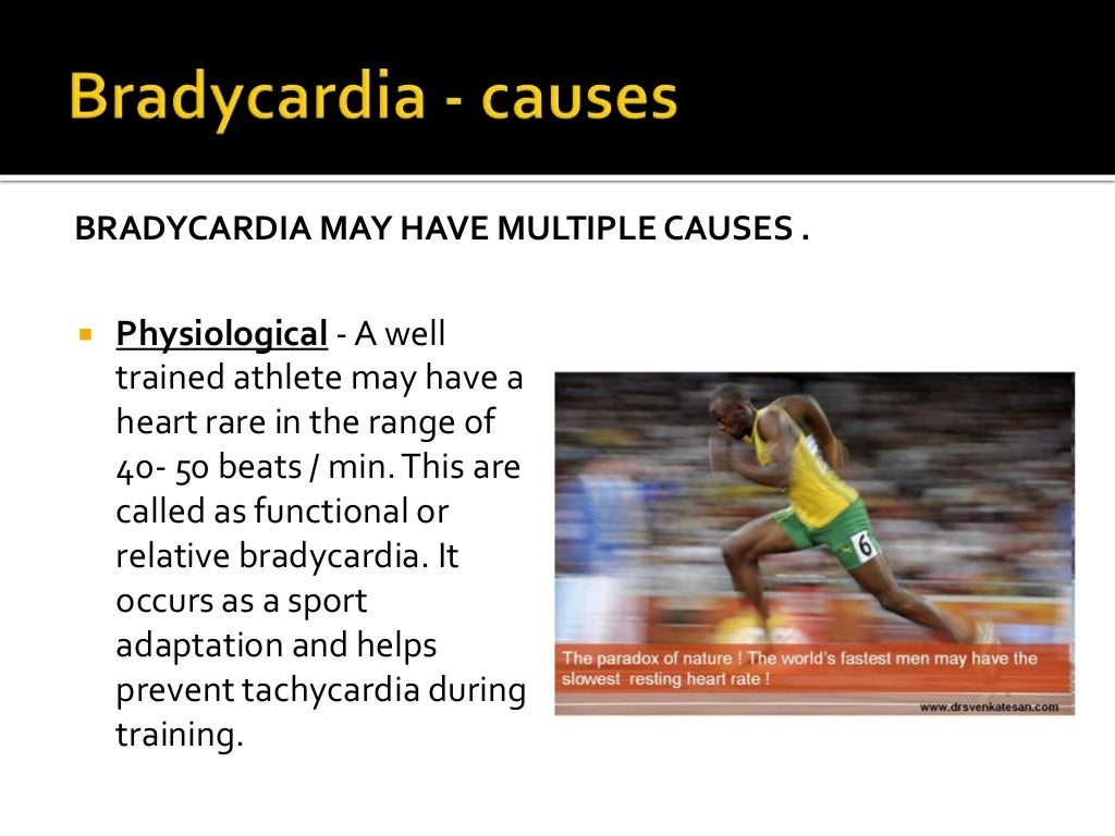 Bradycardia