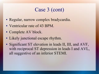 Case 3 (cont)
● Regular, narrow complex bradycardia.
● Ventricular rate of 43 BPM.
● Complete AV block.
● Likely junctional escape rhythm.
● Significant ST elevation in leads II, III, and AVF,
with reciprocal ST depression in leads I and AVL,
all suggestive of an inferior STEMI.
 