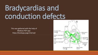 Bradycardias and
conduction defects
This was gathered with the help of
Medicos PDF app:
https://bookapp.page.link/rajit
 