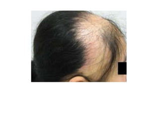 Braids & plaits- powerpoint showing different methods of plaiting hair