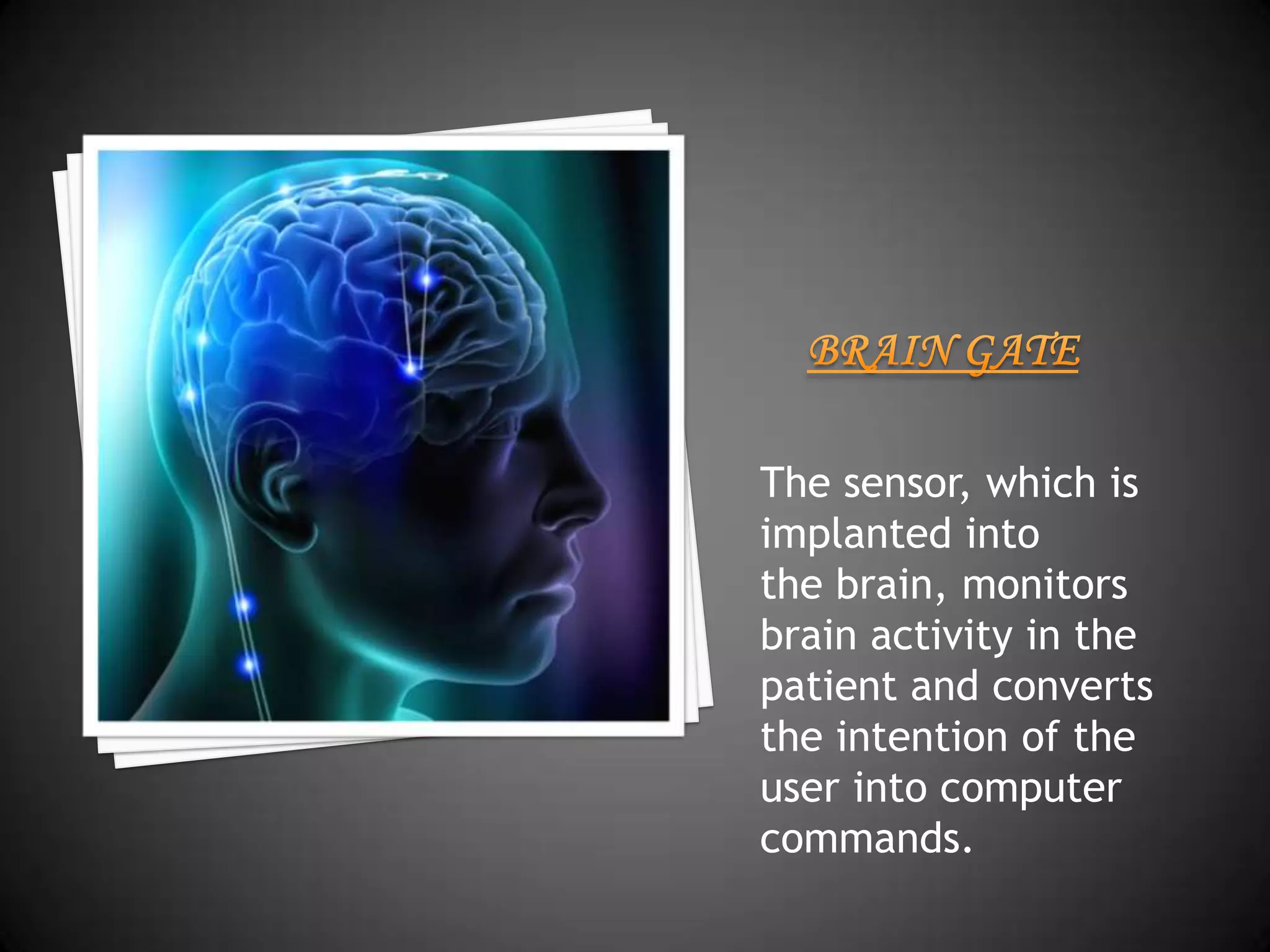 The sensor, which is
implanted into
the brain, monitors
brain activity in the
patient and converts
the intention of the
user into computer
commands.
 
