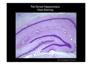 Rat Dorsal Hippocampus
     Nissl Staining




                   Rita Sinigaglia-Coimbra
 