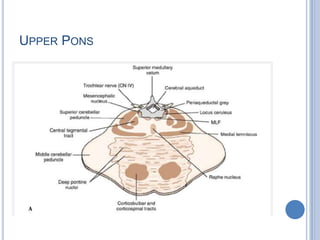 UPPER PONS

 