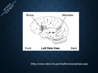 (http://www.nidcd.nih.gov/health/voice/aphasia.asp)
 