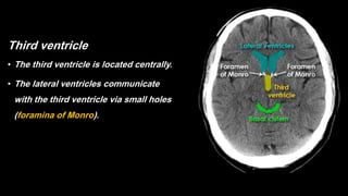 Third ventricle
• The third ventricle is located centrally.
• The lateral ventricles communicate
with the third ventricle via small holes
(foramina of Monro).
 