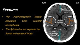 Fissures
• The interhemispheric fissure
separates both cerebral
hemispheres.
• The Sylvian fissures separate the
frontal and temporal lobes.
 