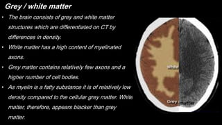 • The brain consists of grey and white matter
structures which are differentiated on CT by
differences in density.
• White matter has a high content of myelinated
axons.
• Grey matter contains relatively few axons and a
higher number of cell bodies.
• As myelin is a fatty substance it is of relatively low
density compared to the cellular grey matter. White
matter, therefore, appears blacker than grey
matter.
Grey / white matter
 