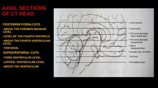 AXIAL SECTIONS
OF CT HEAD
POSTERIOR FOSSA CUTS
-ABOVE THE FORAMEN MAGNUM
LEVEL
-LEVEL OF THE FOURTH VENTRICLE
-ABOVE THE FOURTH VENTRICULAR
LEVEL
-TENTORIAL
SUPRATENTORIAL CUTS
-THIRD VENTRICULAR LEVEL
-LATERAL VENTRICULAR LEVEL
-ABOVE THE VENTRICULAR LEVEL
 
