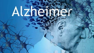 Alzheimer
 