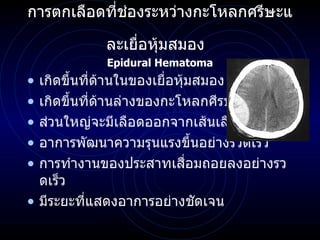 การตกเลือดที่ช่องระหว่างกะโหลกศรีษะและเยื่อหุ้มสมอง   Epidural Hematoma เกิดขึ้นที่ด้านในของเยื่อหุ้มสมอง เกิดขึ้นที่ด้านล่างของกะโหลกศีรษะ ส่วนใหญ่จะมีเลือดออกจากเส้นเลือดแดง อาการพัฒนาความรุนแรงขึ้นอย่างรวดเร็ว การทำงานของประสาทเสื่อมถอยลงอย่างรวดเร็ว มีระยะที่แสดงอาการอย่างชัดเจน 