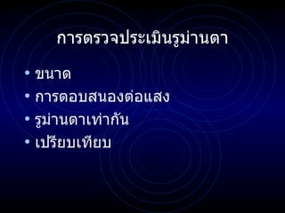 การตรวจประเมินรูม่านตา ขนาด การตอบสนองต่อแสง รูม่านตาเท่ากัน เปรียบเทียบ 
