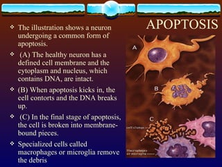 APOPTOSIS The illustration shows a neuron undergoing a common form of apoptosis. (A) The healthy neuron has a defined cell membrane and the cytoplasm and nucleus, which contains DNA, are intact.  (B) When apoptosis kicks in, the cell contorts and the DNA breaks up. (C) In the final stage of apoptosis, the cell is broken into membrane-bound pieces.  Specialized cells called macrophages or microglia remove the debris 