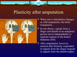 Plasticity after amputation When nerve stimulation changes, as with amputation, the brain reorganizes. In one theory, signals from a finger and thumb of an uninjured person travel independantly to separate regions in the brain's thalamus (left).  After amputation, however, neurons that formerly responded to signals from the finger respond to signals from the thumb (right).  