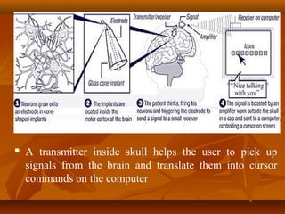    A transmitter inside skull helps the user to pick up
    signals from the brain and translate them into cursor
    com...