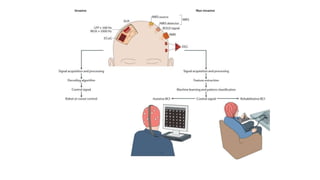 Brain Computer Interface (BCI) | PPTX