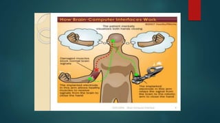 brain-computer interfaces explained: 7 critical... Brain computer interface | PPTX