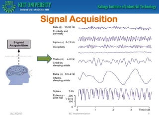 Signal Acquisition

11/23/2013

BCI Implementation

9

 