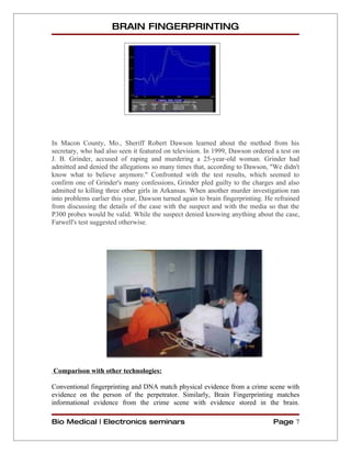 Brain fingerprinting | DOC