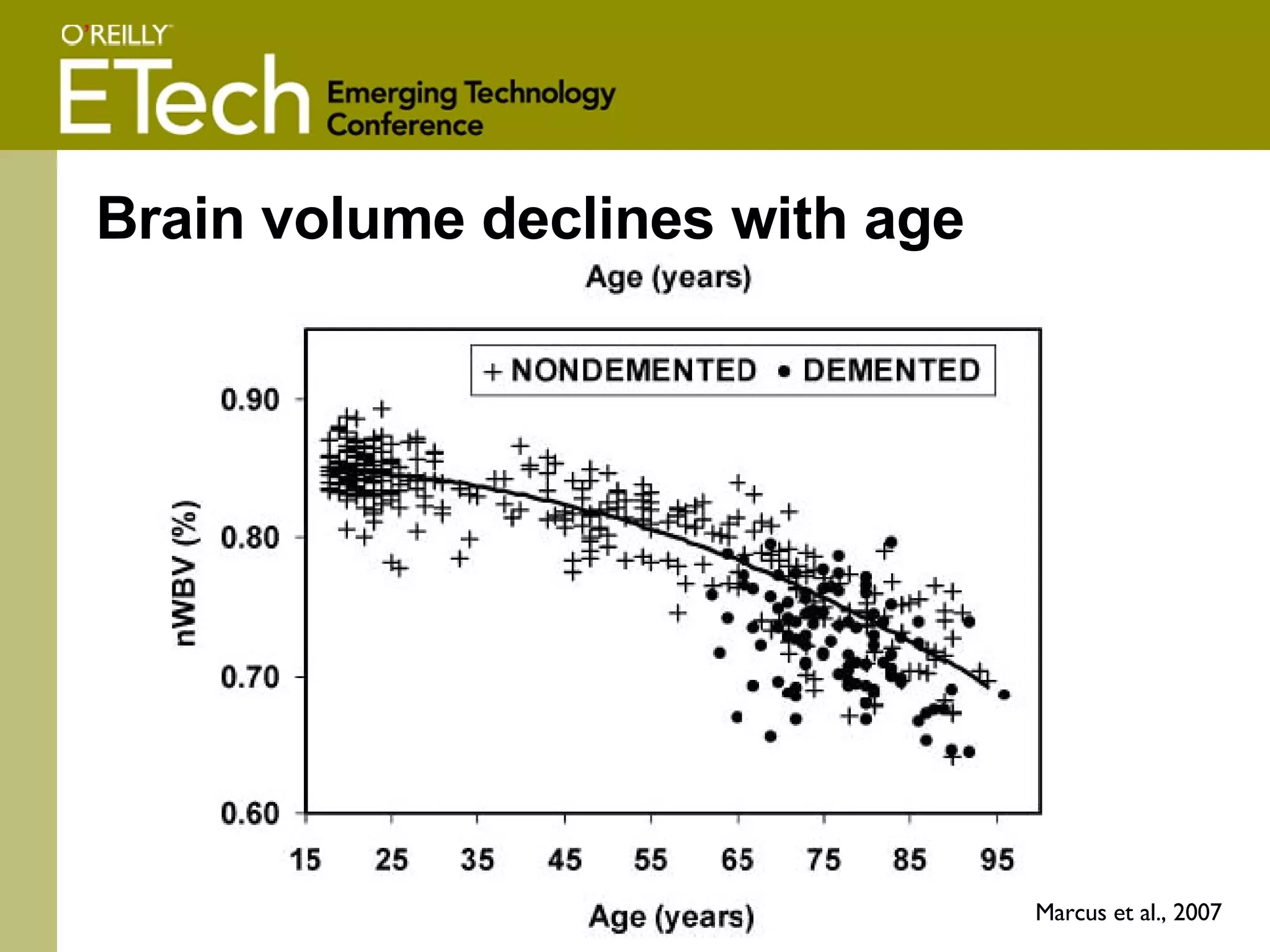 Brain volume declines with age Marcus et al., 2007 