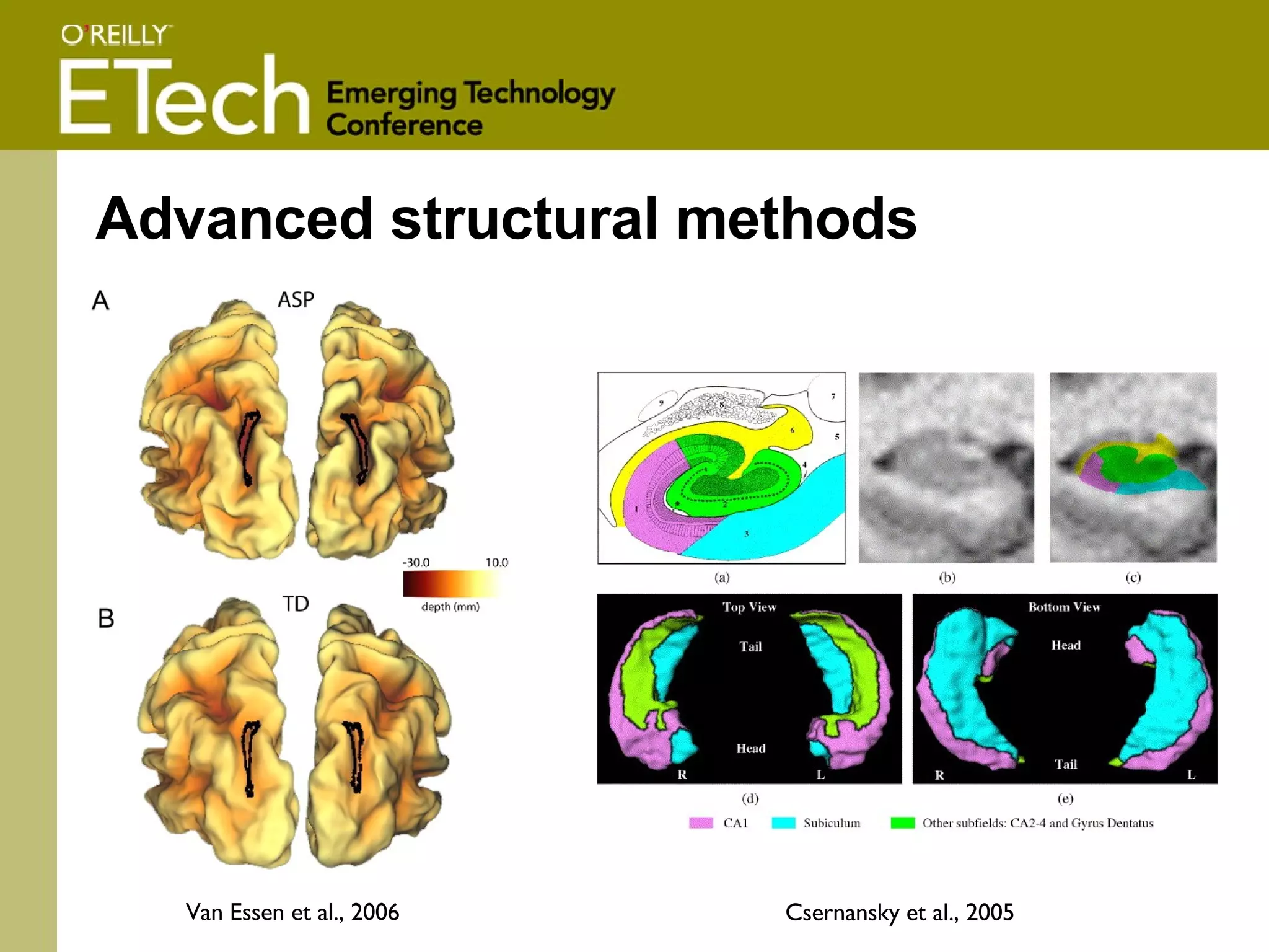 Advanced structural methods Van Essen et al., 2006 Csernansky et al., 2005 