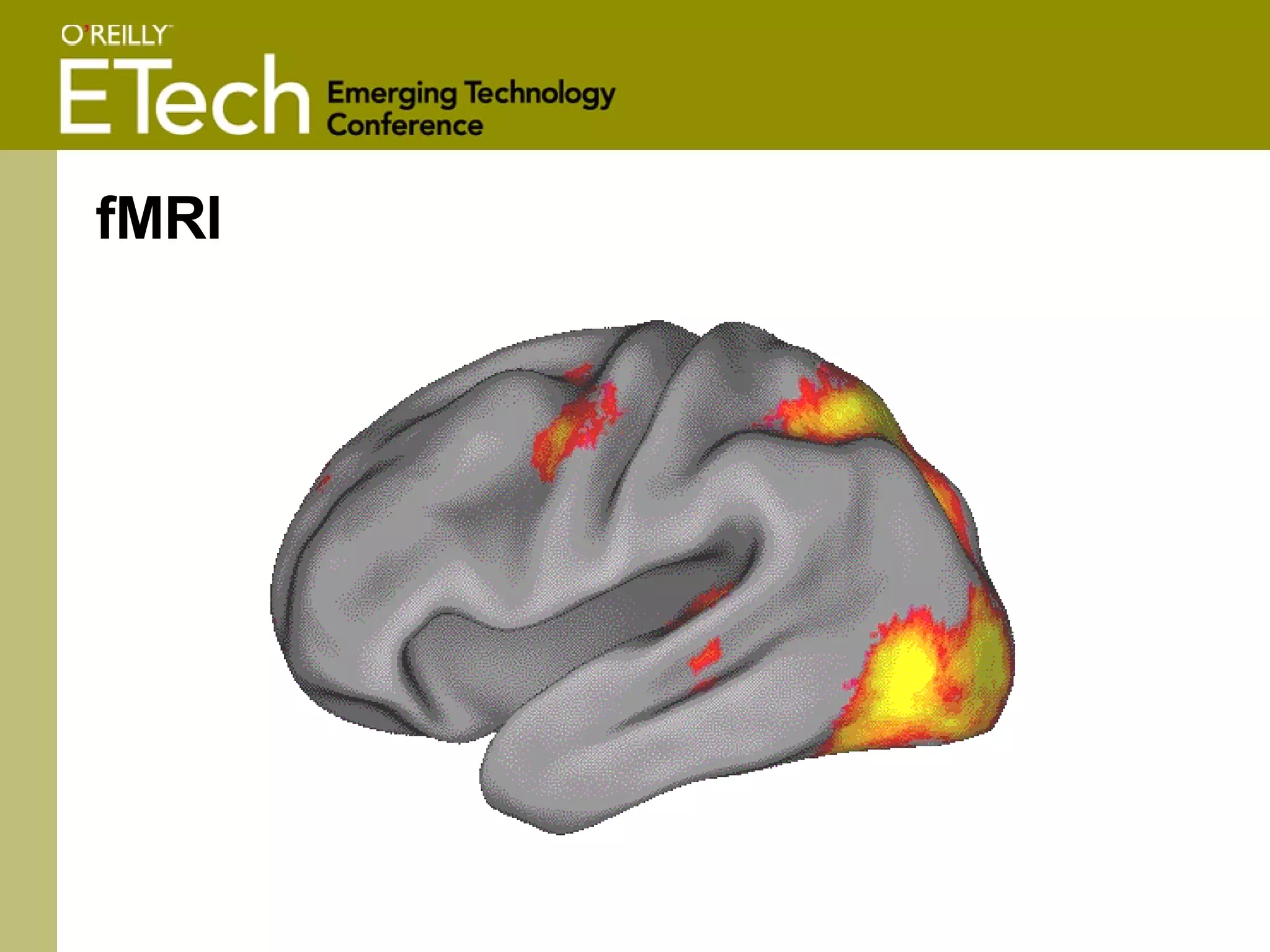 fMRI 