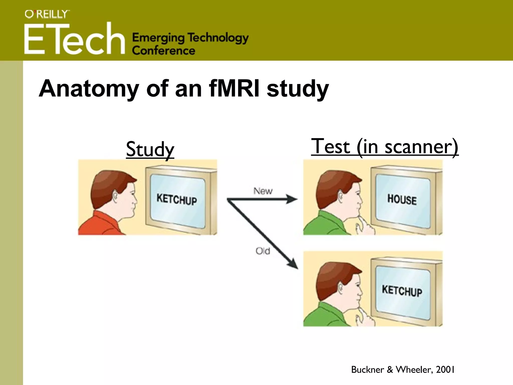 Anatomy of an fMRI study Buckner & Wheeler, 2001 Study Test (in scanner) 