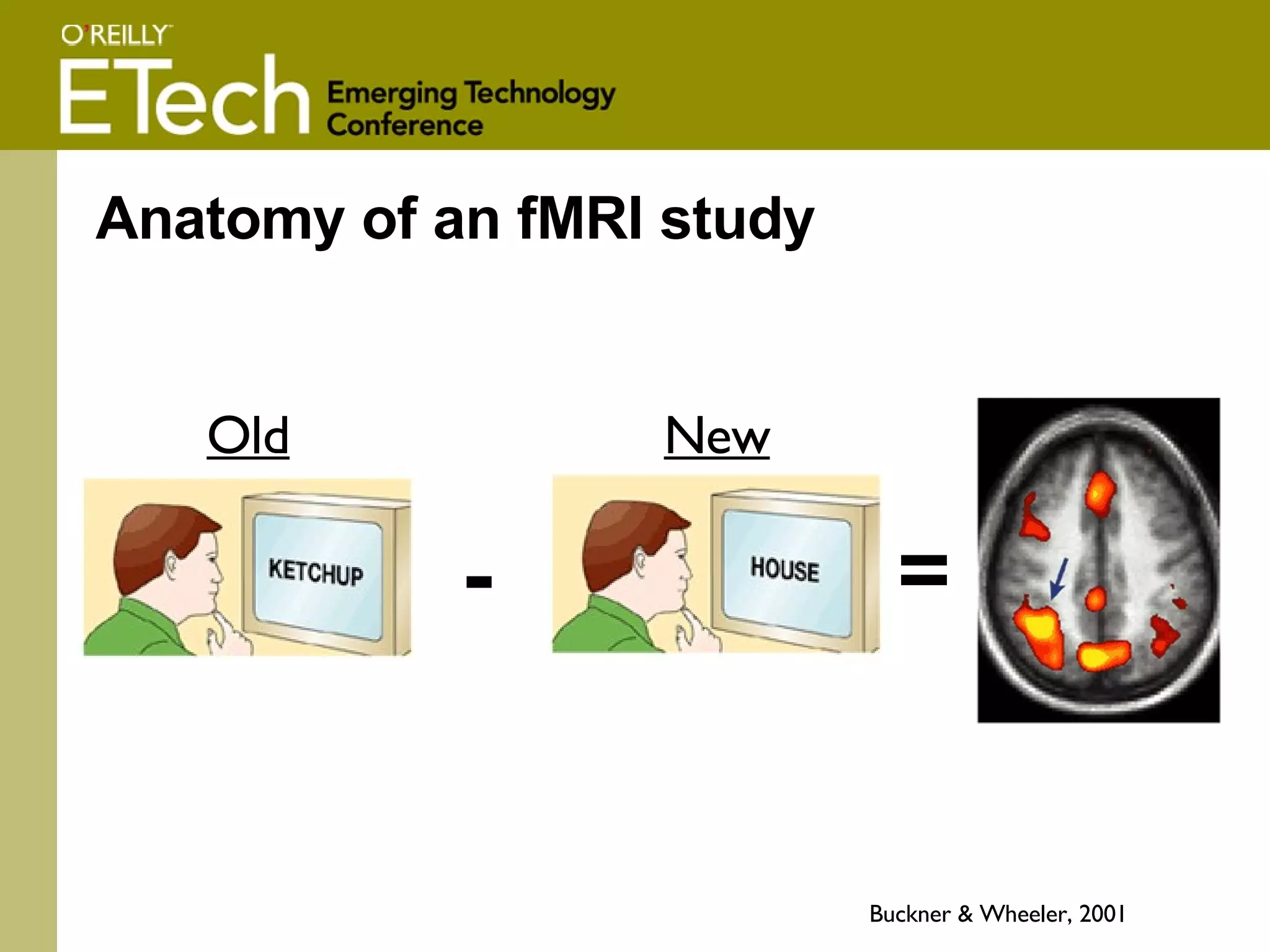 Anatomy of an fMRI study Buckner & Wheeler, 2001 - = Old New 