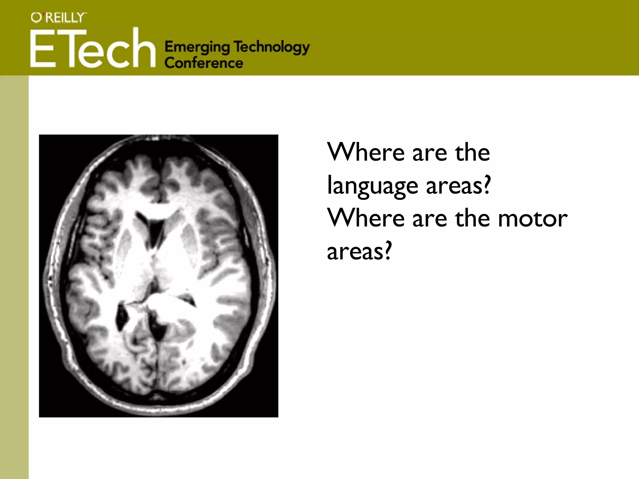 Where are the language areas?  Where are the motor areas? 