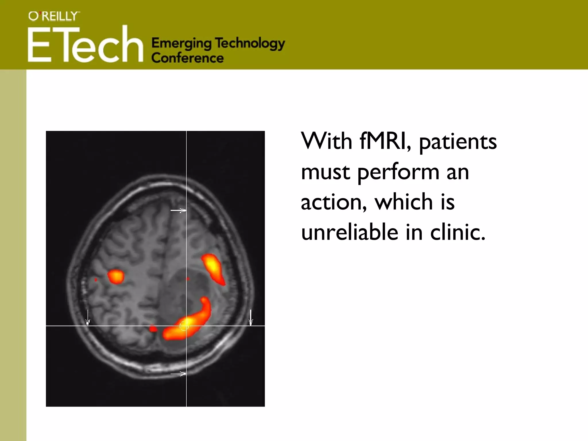 With fMRI, patients must perform an action, which is unreliable in clinic. 
