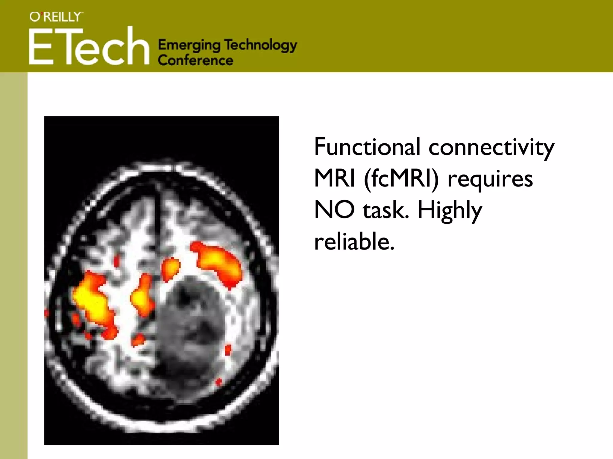 Functional connectivity MRI (fcMRI) requires NO task. Highly reliable. 