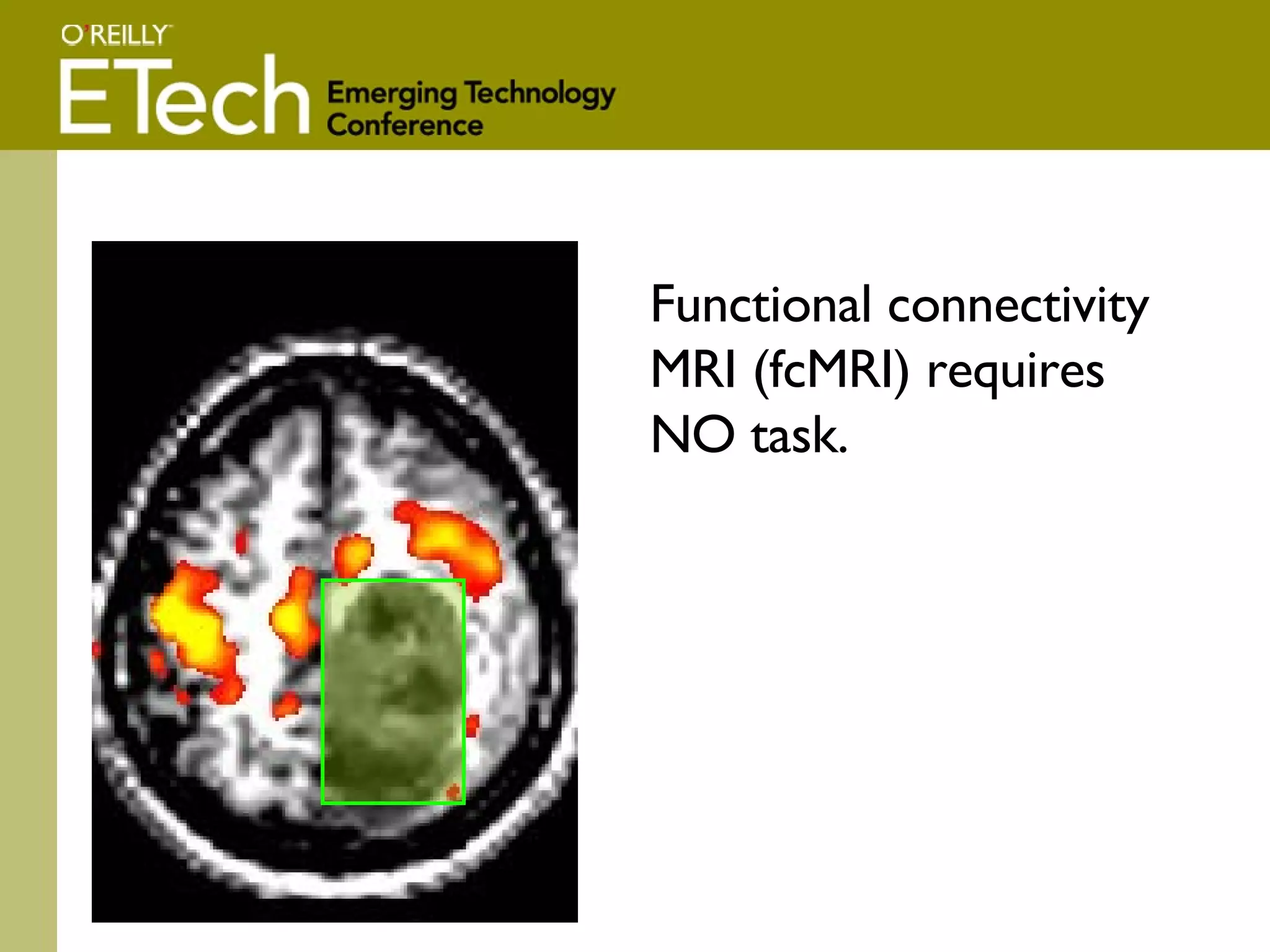 Functional connectivity MRI (fcMRI) requires NO task. 