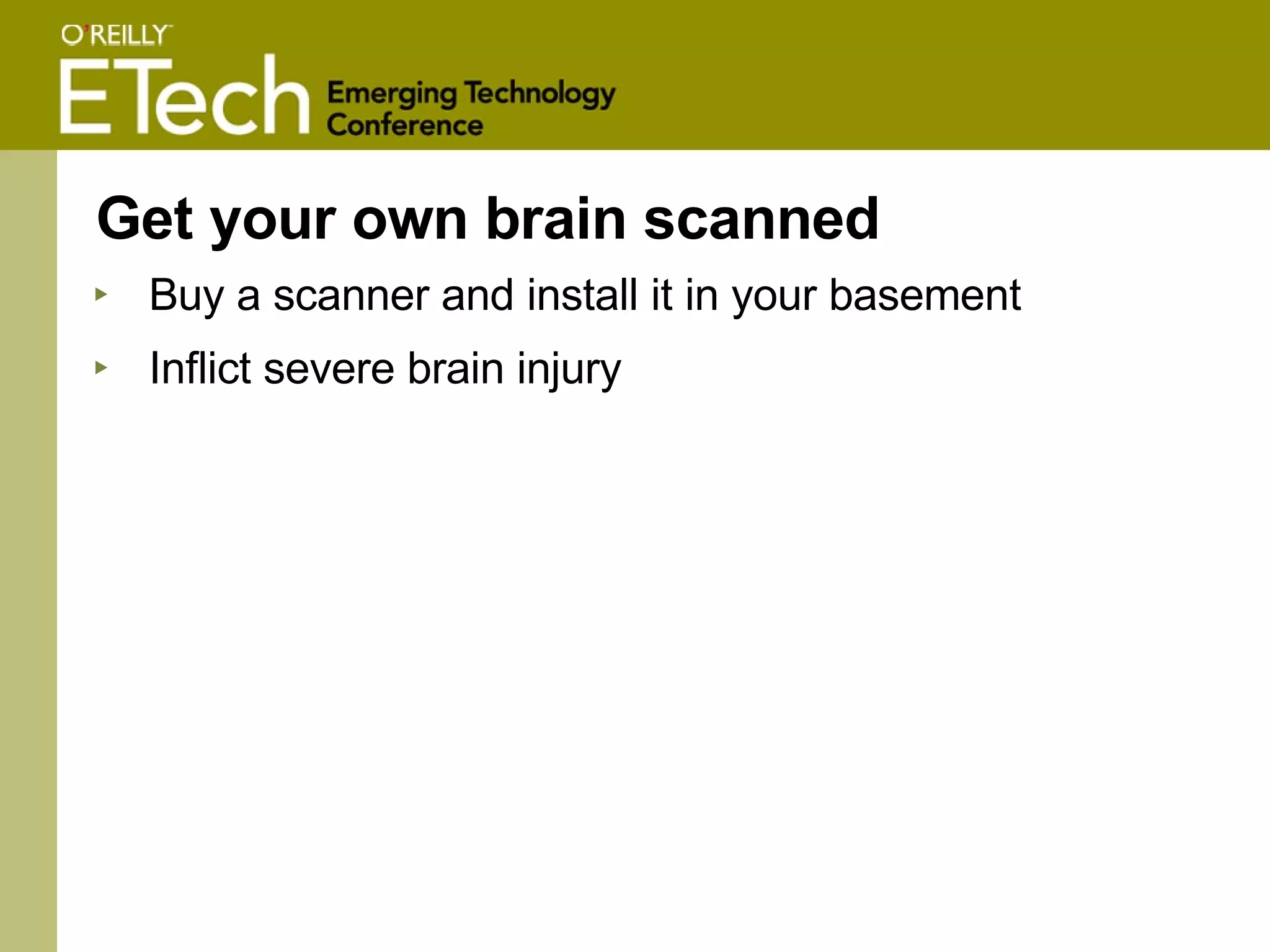 Get your own brain scanned Buy a scanner and install it in your basement Inflict severe brain injury 