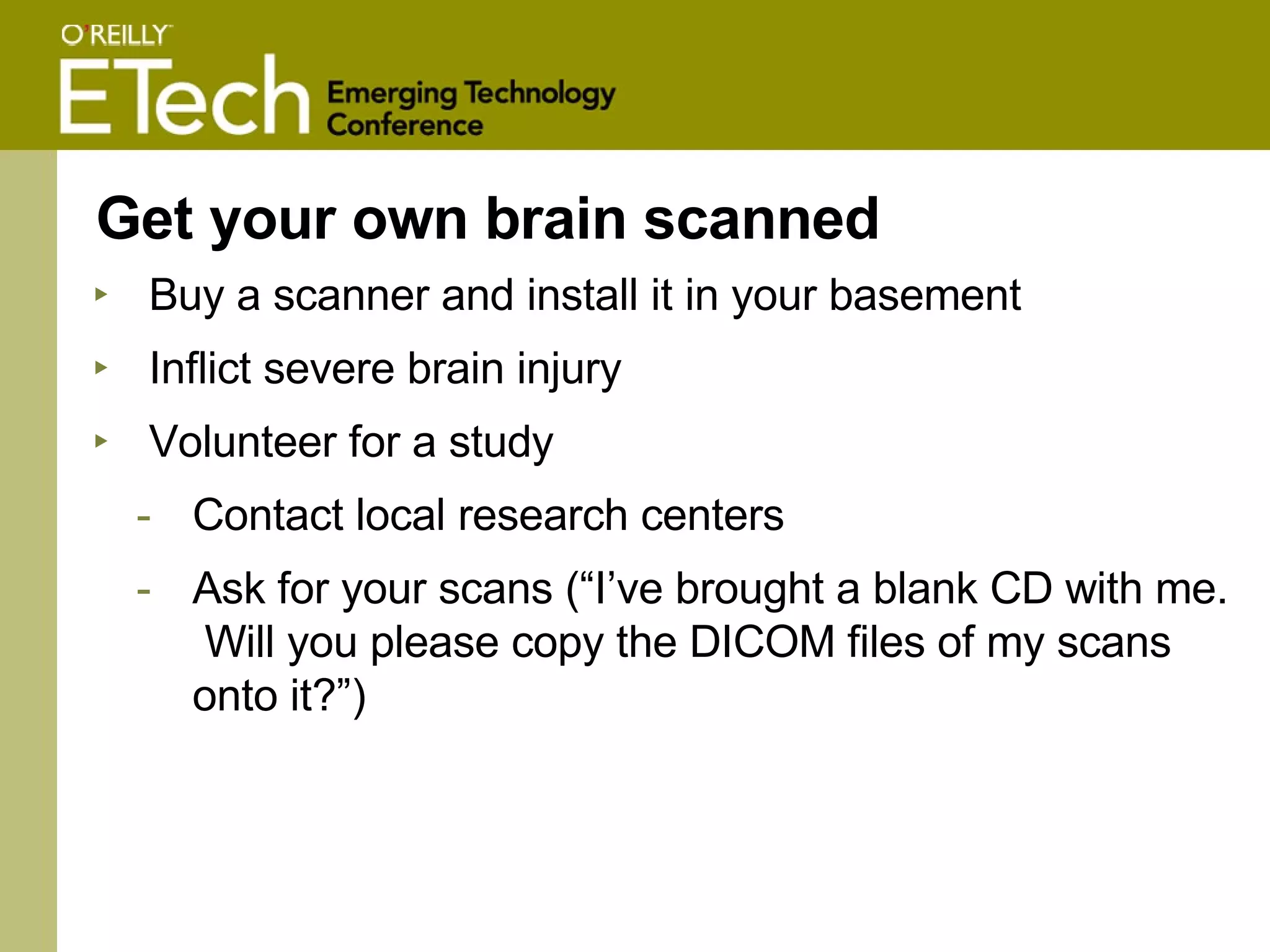 Get your own brain scanned Buy a scanner and install it in your basement Inflict severe brain injury Volunteer for a study Contact local research centers  Ask for your scans (“I’ve brought a blank CD with me.  Will you please copy the DICOM files of my scans onto it?”) 