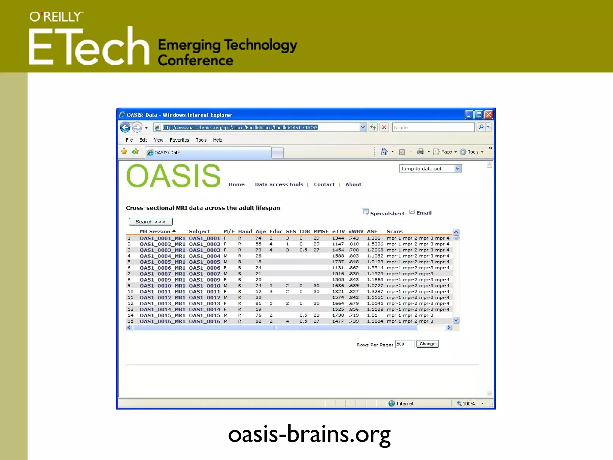 oasis-brains.org 