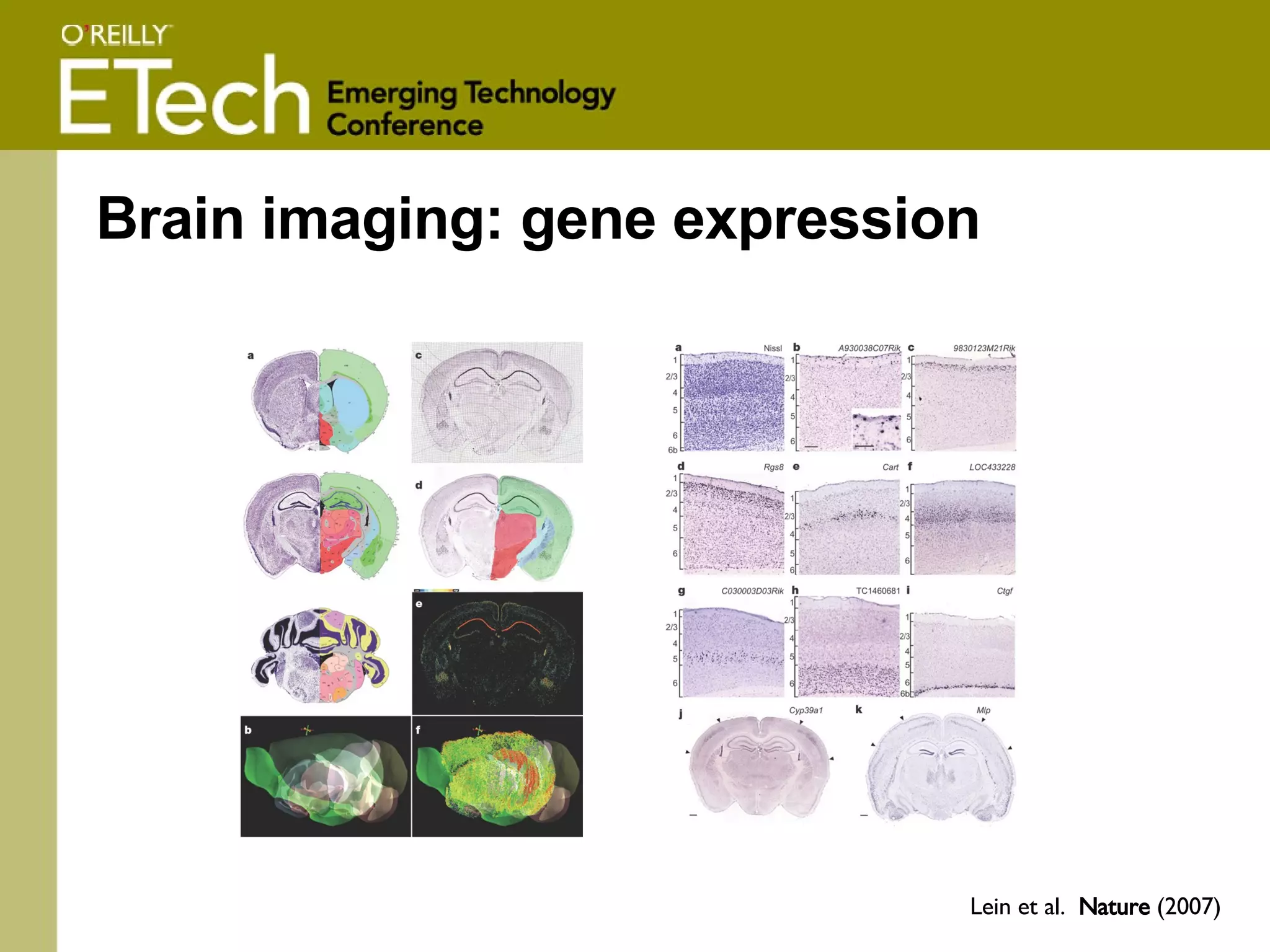 Brain imaging: gene expression Lein et al.  Nature  (2007) 