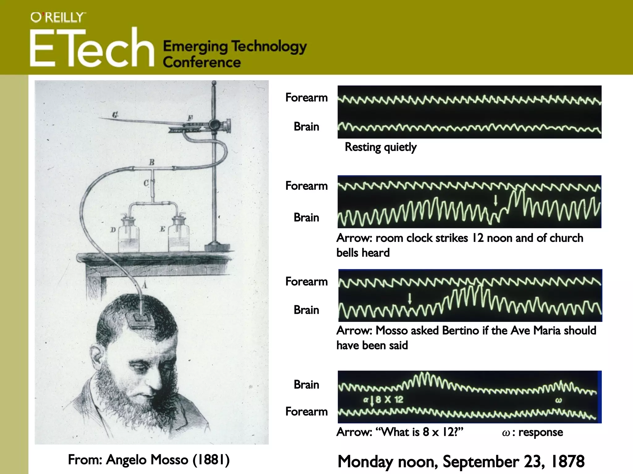 Monday noon, September 23, 1878 From: Angelo Mosso (1881) Resting quietly Forearm Brain Arrow: room clock strikes 12 noon and of church bells heard Brain Forearm Arrow: Mosso asked Bertino if the Ave Maria should have been said Brain Forearm Arrow: “What is 8 x 12?”  ω : response Brain Forearm 